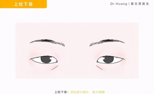 三角眼是什么眼型图片