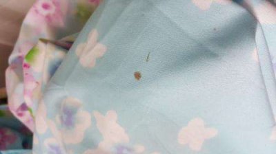 衣服上有血渍怎么清洗最有效 如何处理衣服上的血渍