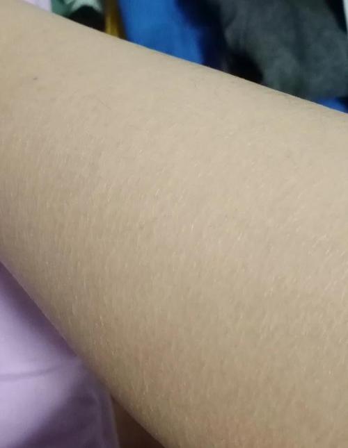 鱼鳞上有白色絮状物（鱼鳞白絮和白云病混合感染的防控要点）