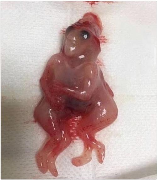 17胞胎是真的吗(17胞胎传言是真是假?看权威证据与核验要点)